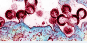 Pembro flush HIV from its hiding spots